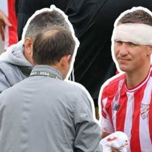 Вячеслав Посмак получил травму головы в матче за "Болуспор". Ему наложили 18 швов (фото)